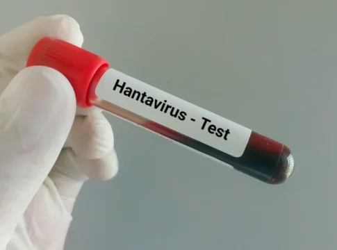 Hantavirus