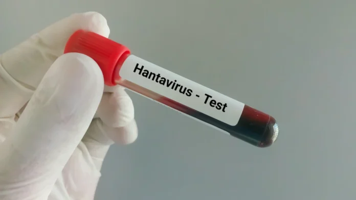 Hantavirus